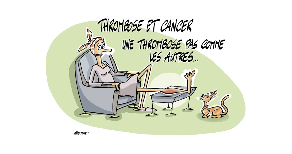 Thrombose et Cancer : une thrombose pas comme les autres…